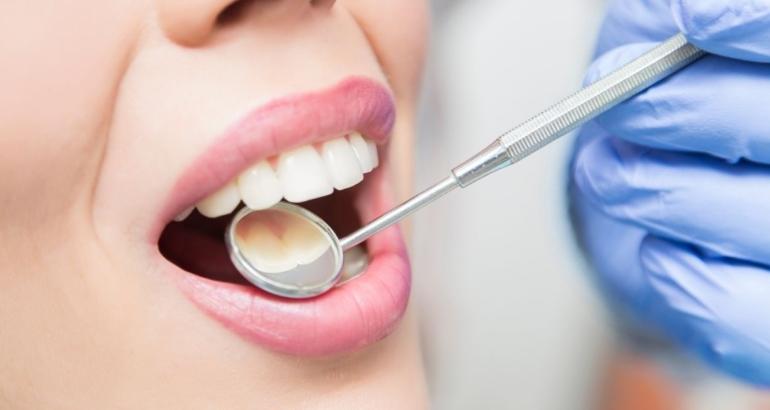 Dental Checkup And Consultation