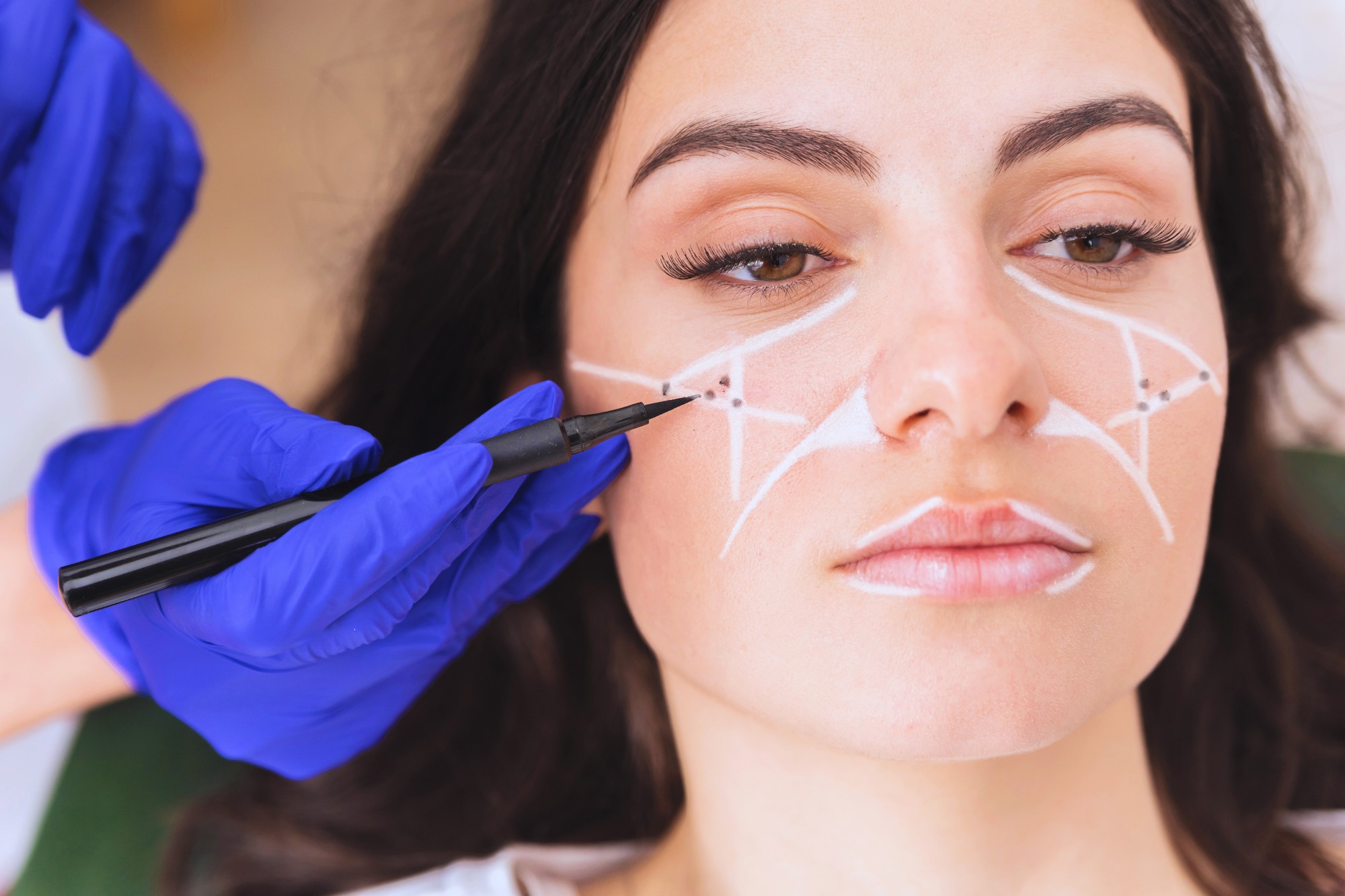 MDW-Blog-Aesthetic Treatments - MDW Centre MDW-Aesthetic Treatments