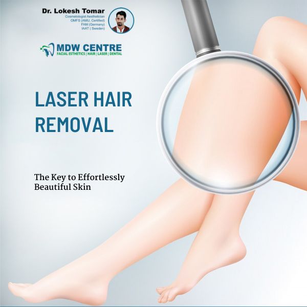 MDW Centre - Top Laser Treatments in Aligarh