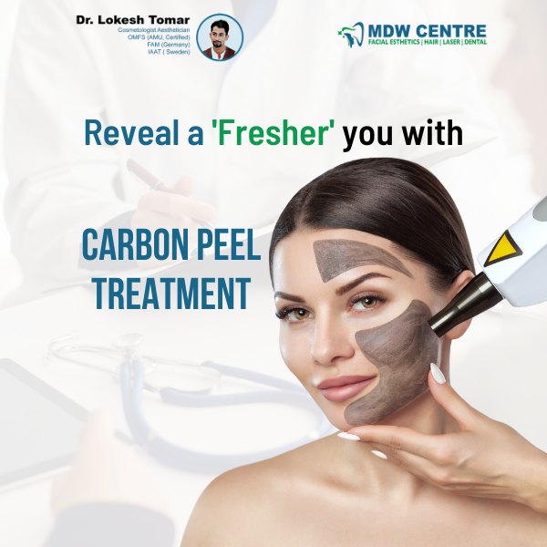 MDW Centre - Carbon Peel treatment in Aligarh