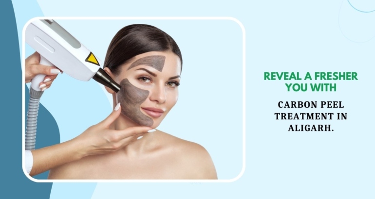 Reveal a Fresher you with Carbon Peel treatment in Aligarh.