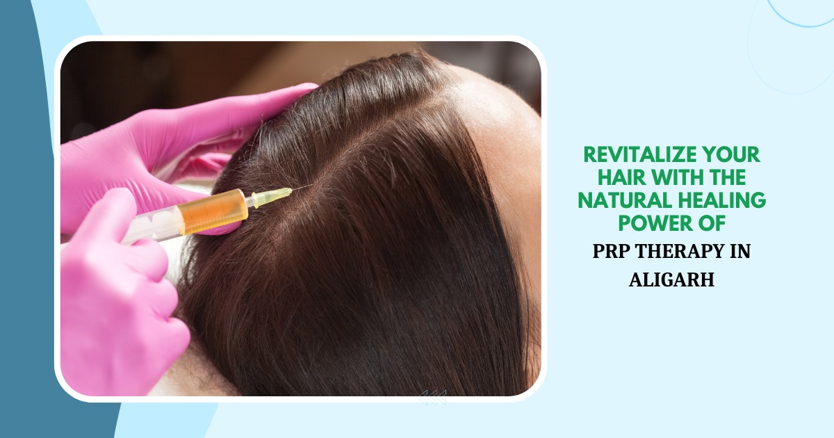 MDW Centre - Revitalize Your Hair with the Natural Healing Power of PRP Therapy in Aligarh