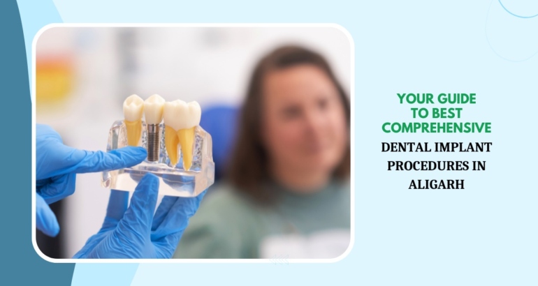 MDW Centre - Your Guide to Best Comprehensive Dental Implant Procedures in Aligarh