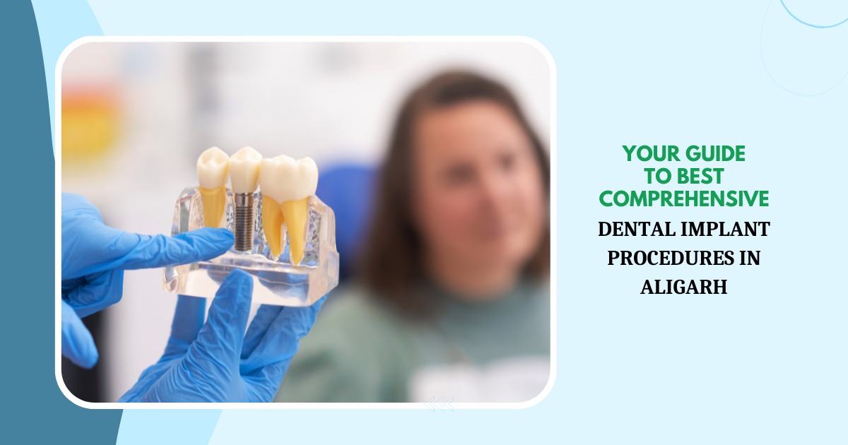 MDW Centre - Your Guide to Best Comprehensive Dental Implant Procedures in Aligarh - MDW Centre MDW Centre - Your Guide to Best Comprehensive Dental Implant Procedures in Aligarh