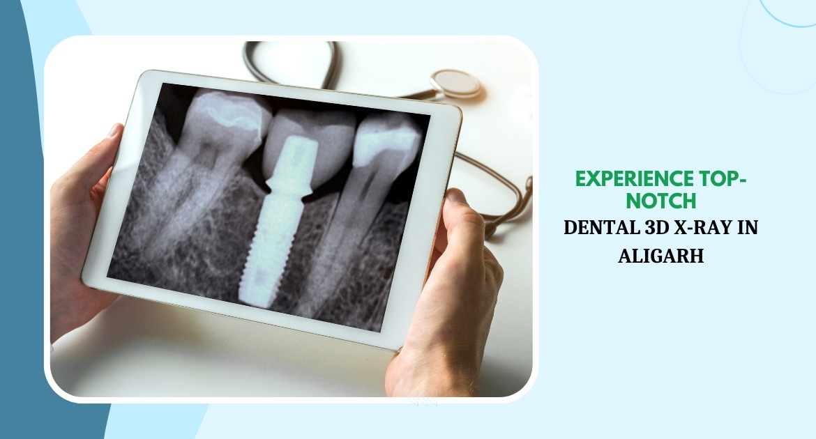 MDW Centre - Experience Top-Notch Dental 3D X-Ray in Aligarh