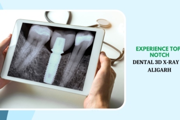 MDW Centre - Experience Top-Notch Dental 3D X-Ray in Aligarh