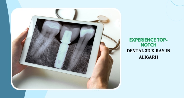 Experience Top-Notch Dental 3D X-Ray in Aligarh