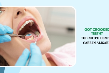 MDW Centre - Got Crooked Teeth_ Top-Notch Dental Care in Aligarh
