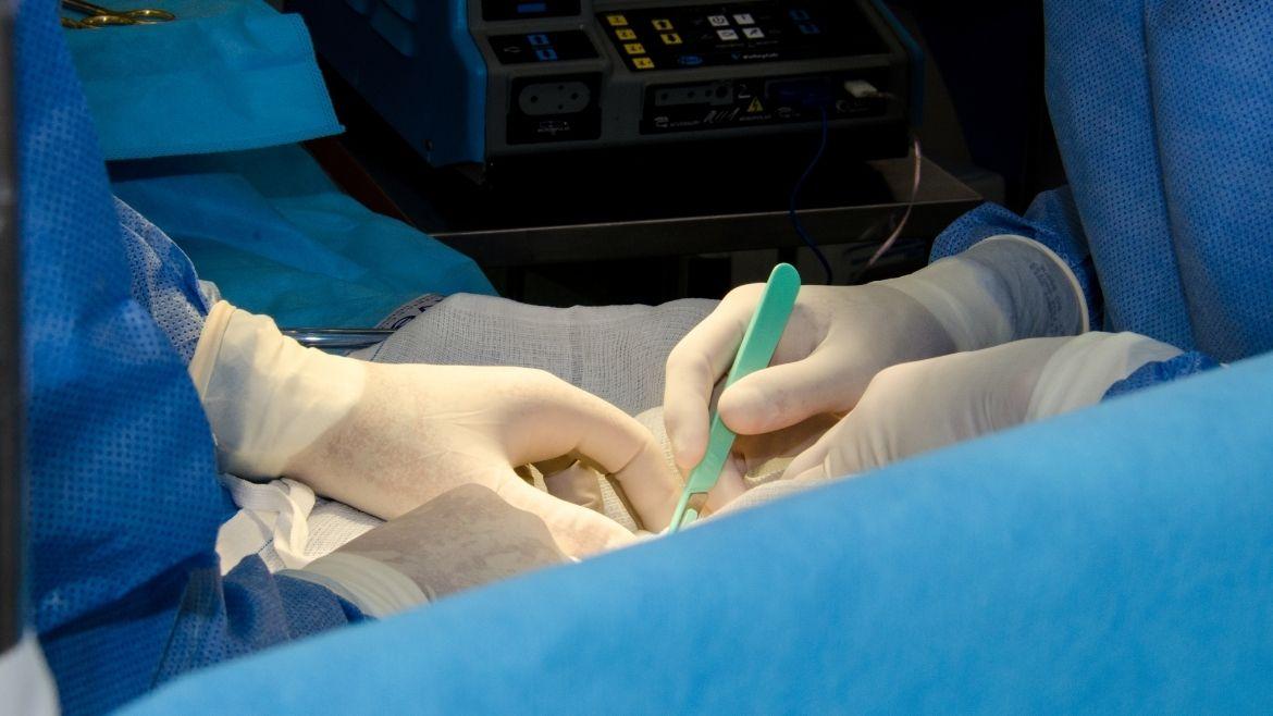 MDW-Centre-Burn-Surgery - MDW Centre MDW-Centre-Burn-Surgery