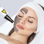 MDW Centre - Dr Lokesh Tomars Expert Carbon Peel Treatment in Aligarh - MDW Centre MDW Centre - Dr Lokesh Tomars Expert Carbon Peel Treatment in Aligarh