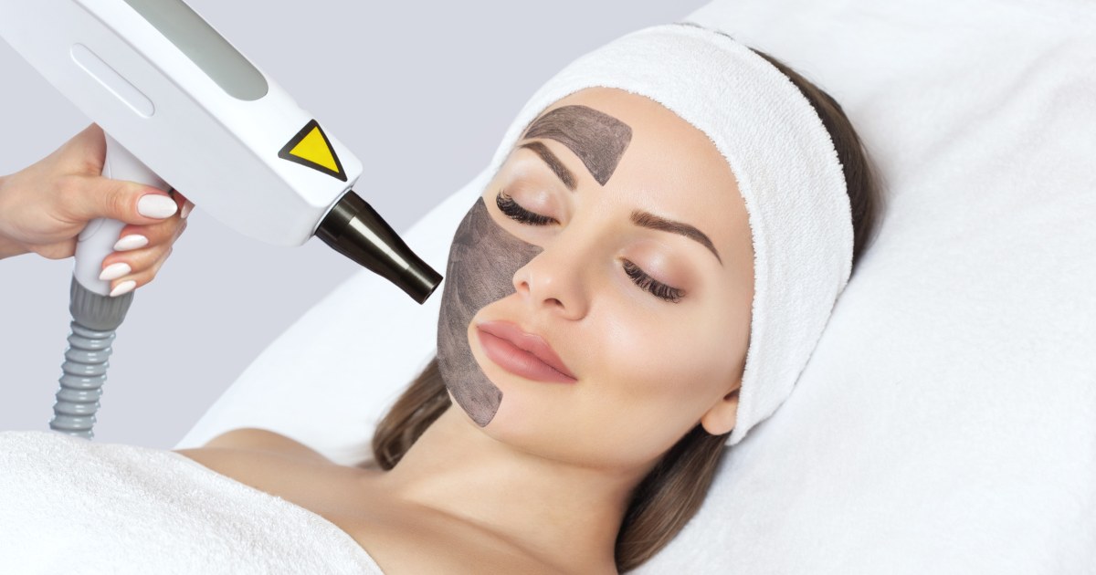 MDW Centre - Dr Lokesh Tomars Expert Carbon Peel Treatment in Aligarh