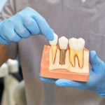 MDW Centre - Why is Dr Lokesh Tomar the Top Dental Surgeon in Aligarh - MDW Centre MDW Centre - Why is Dr Lokesh Tomar the Top Dental Surgeon in Aligarh