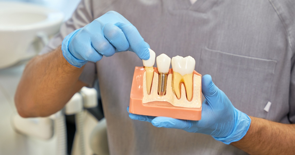 MDW Centre - Why is Dr Lokesh Tomar the Top Dental Surgeon in Aligarh - MDW Centre MDW Centre - Why is Dr Lokesh Tomar the Top Dental Surgeon in Aligarh