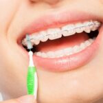 MDW Centre - Achieve the Perfect Smile with Orthodontic Treatment in Aligarh - MDW Centre MDW Centre - Achieve the Perfect Smile with Orthodontic Treatment in Aligarh