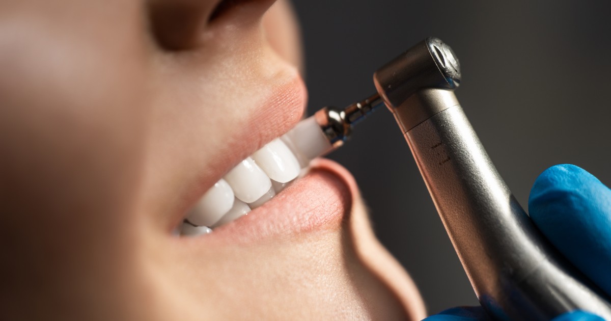 MDW Centre - Best Dental Surgeon in Aligarh for a Healthy Smile - MDW Centre MDW Centre - Best Dental Surgeon in Aligarh for a Healthy Smile