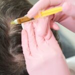 MDW Centre - Top Hair Restoration Solutions by the Best Hair Specialist in Aligarh - MDW Centre MDW Centre - Top Hair Restoration Solutions by the Best Hair Specialist in Aligarh