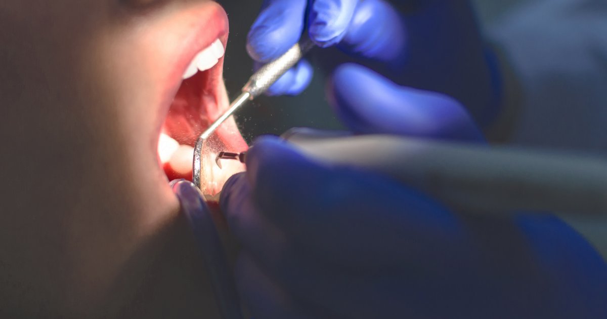 MDW Centre - Achieve a Healthy Smile with the Best Dentist in Aligarh - MDW Centre MDW Centre - Achieve a Healthy Smile with the Best Dentist in Aligarh