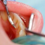 MDW Centre - Smile Brighter with the Top Dental Surgeon in Aligarh - MDW Centre MDW Centre - Smile Brighter with the Top Dental Surgeon in Aligarh