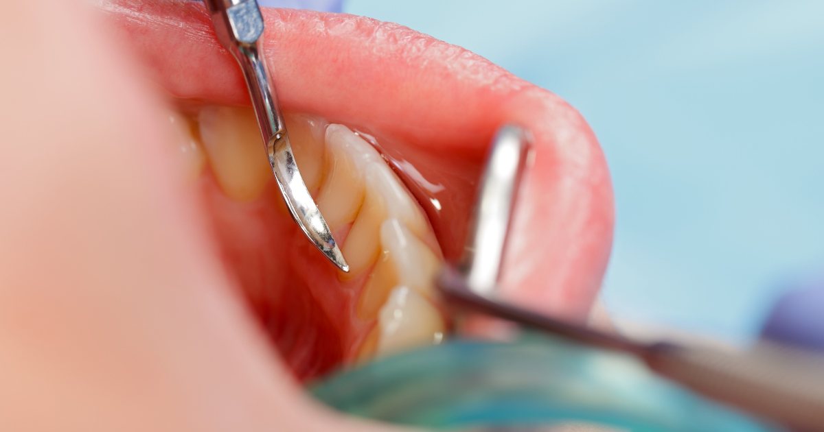 MDW Centre - Smile Brighter with the Top Dental Surgeon in Aligarh - MDW Centre MDW Centre - Smile Brighter with the Top Dental Surgeon in Aligarh