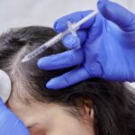 MDW Centre - Why Dr Lokesh Tomar Is Trusted as the Best Hair Specialist in Aligarh