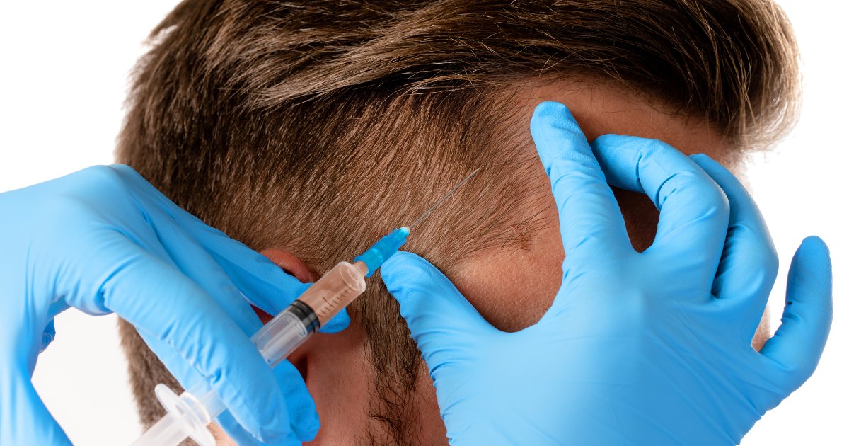 MDW Centre - Find the Best Hair Specialist in Aligarh for Hair Loss Solutions - MDW Centre