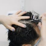 MDW Centre - Advanced Hair Loss Solutions with Hair Treatment in Aligarh