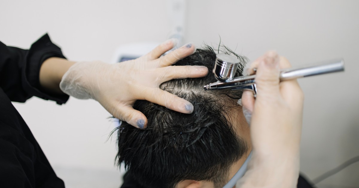 MDW Centre - Advanced Hair Loss Solutions with Hair Treatment in Aligarh - MDW Centre MDW Centre - Advanced Hair Loss Solutions with Hair Treatment in Aligarh