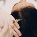 Best Hair Treatment Doctor in Aligarh Near You Now