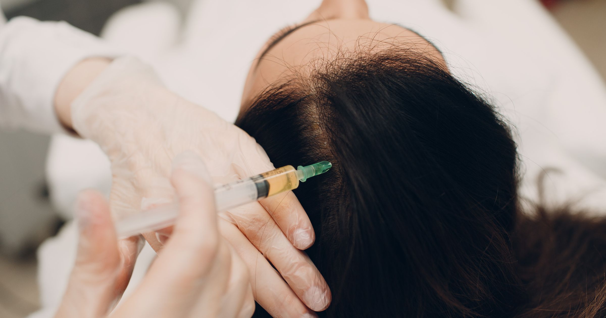 Best Hair Treatment Doctor in Aligarh Near You Now - MDW Centre Best Hair Treatment Doctor in Aligarh Near You Now