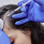 Best Hair Treatment Doctor in Aligarh for Hair Care