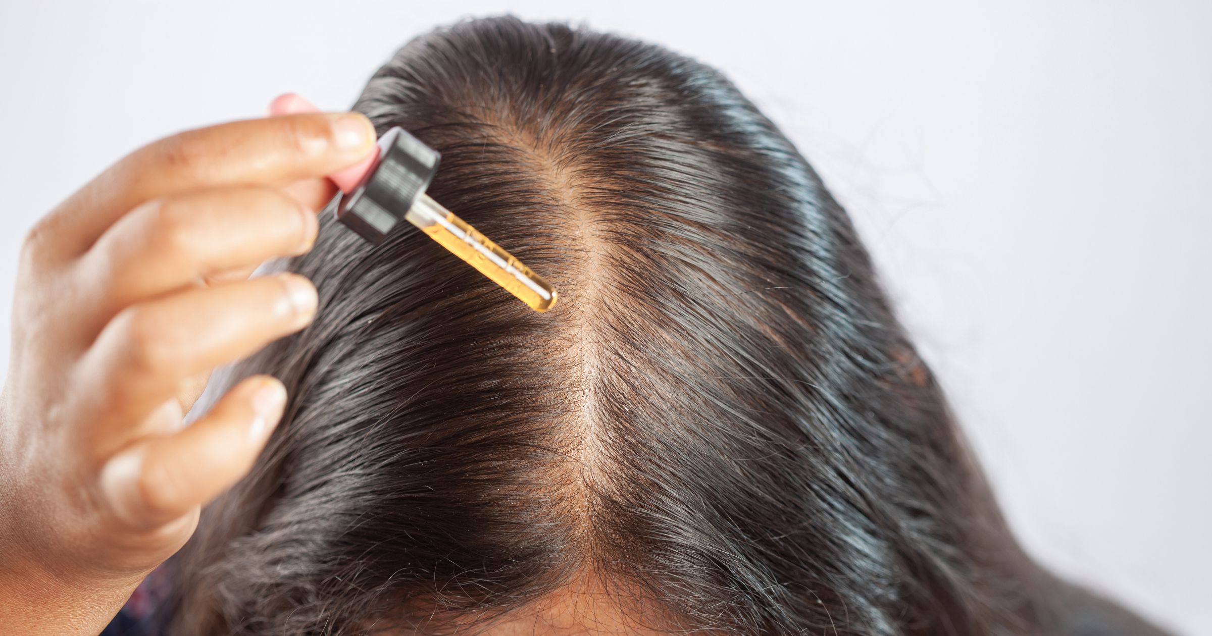 Consult Best Hair Treatment Doctor in Aligarh - MDW Centre Consult Best Hair Treatment Doctor in Aligarh