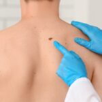 Dermatologist in Aligarh for Complete Skin Care Treatment - MDWCentre