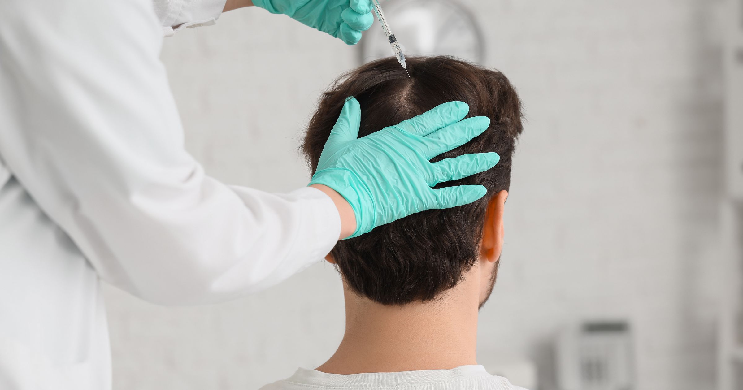 Hair Transplant in Aligarh for Natural Hair Results - MDW Centre Hair Transplant in Aligarh for Natural Hair Results
