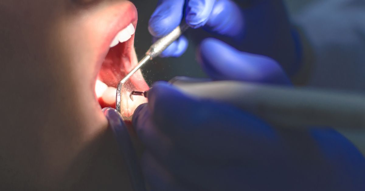 How to Find the Best Dentist in Aligarh Near You