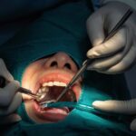 MDW Centre - Best Dental Surgeon in Aligarh Complete Patient Guide