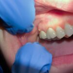 MDW Centre - Best Dental Surgeon in Aligarh for Quality Care