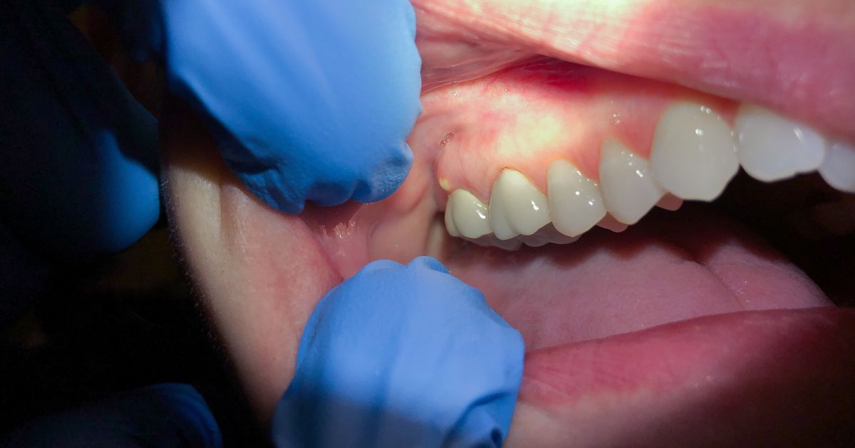 MDW Centre - Best Dental Surgeon in Aligarh for Quality Care - MDW Centre MDW Centre - Best Dental Surgeon in Aligarh for Quality Care