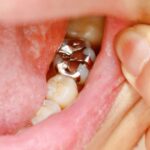 MDW Centre - Best Dental Surgeon in Aligarh for Quality Dental Care