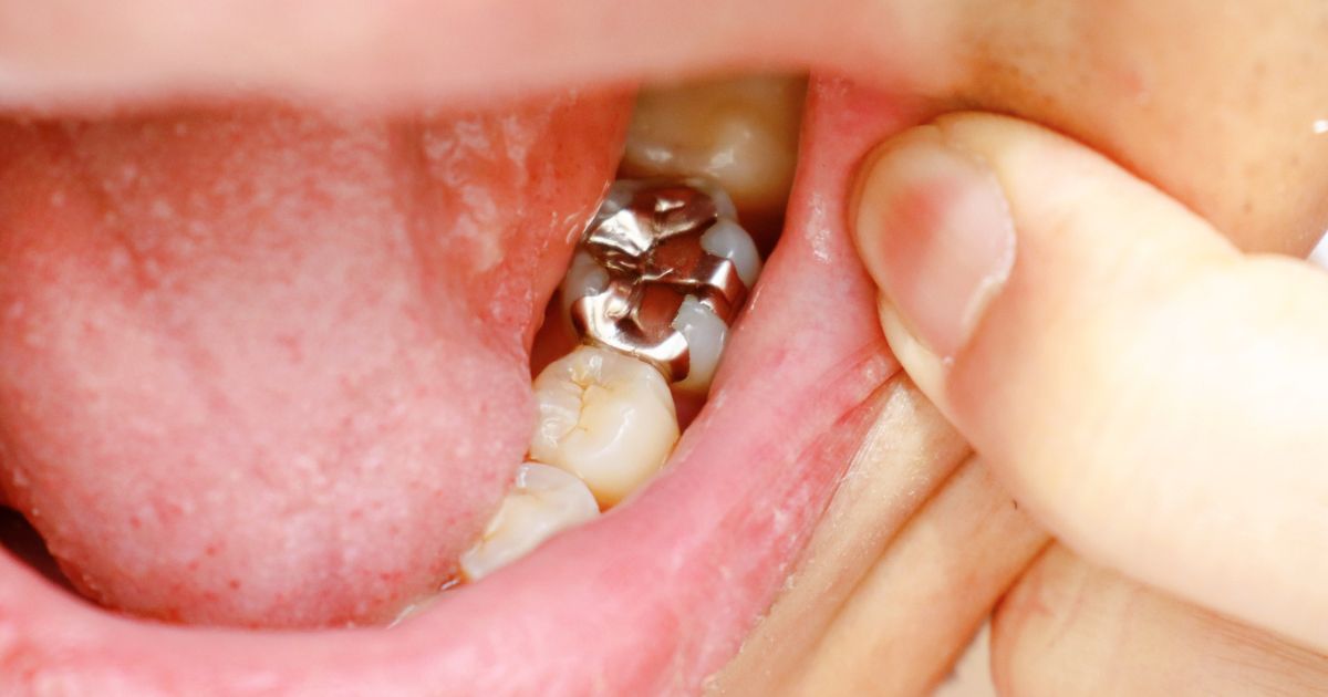 MDW Centre - Best Dental Surgeon in Aligarh for Quality Dental Care