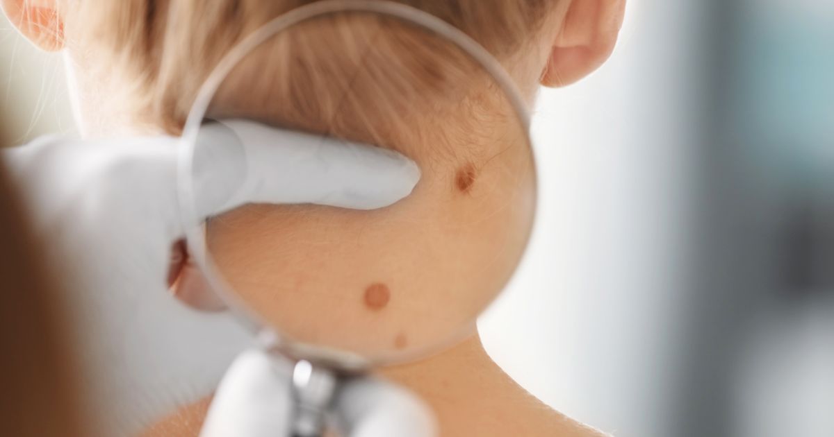 MDW Centre - Best Dermatologist in Aligarh for Hair Treatment