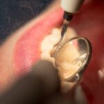 MDW Centre - Expert Dental Surgeon Services in Aligarh