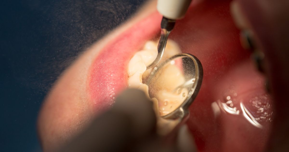 MDW Centre - Expert Dental Surgeon Services in Aligarh