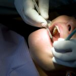 MDW Centre - Expert Dental Surgeon in Aligarh for Advanced Dental Treatments