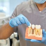MDW Centre - How to Choose the Best Dental Surgeon in Aligarh Introduction
