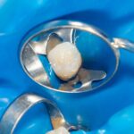 MDW Centre - Why You Should Visit an Experienced Dental Surgeon in Aligarh