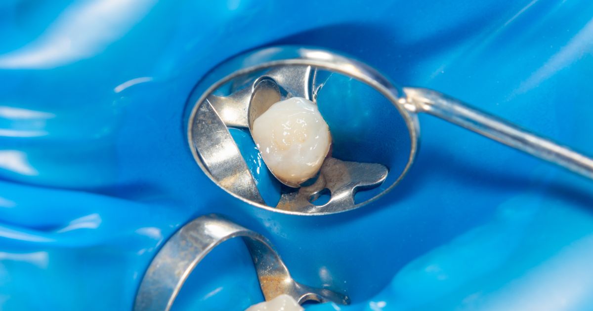 MDW Centre - Why You Should Visit an Experienced Dental Surgeon in Aligarh