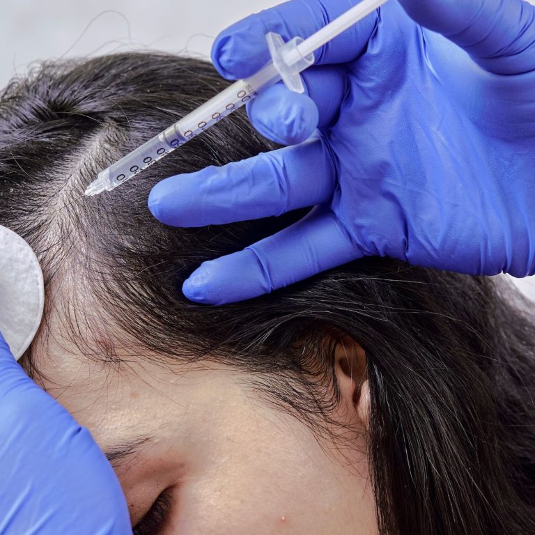 Best Hair Treatment Doctor in Aligarh for Hair Care