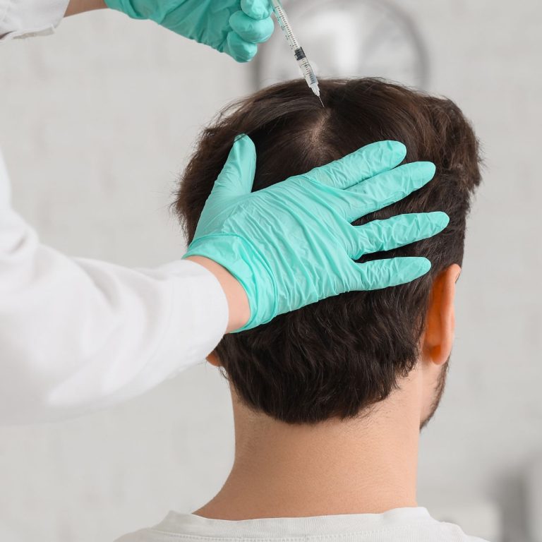 Hair Transplant in Aligarh for Natural Hair Results