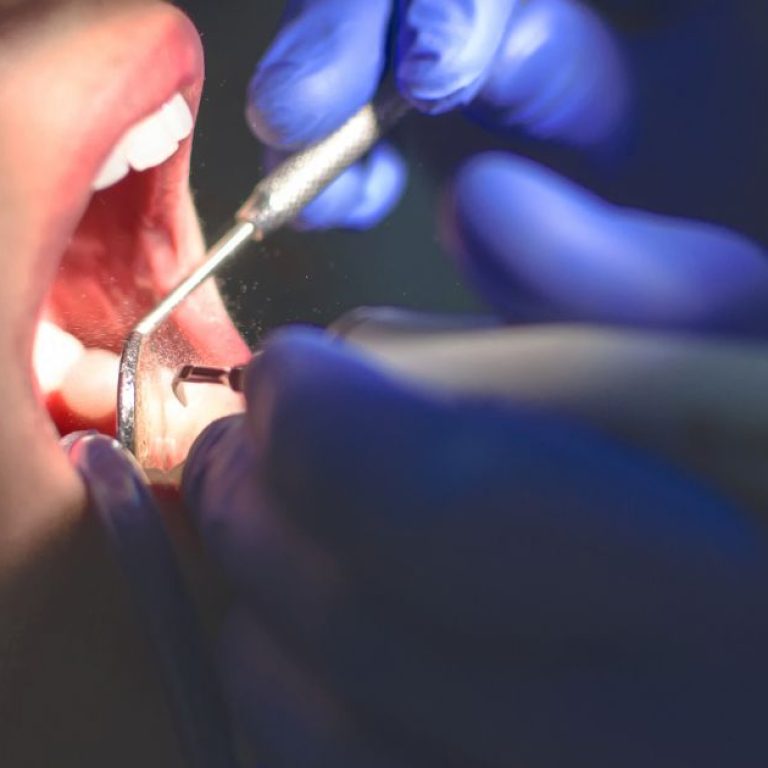 How to Find the Best Dentist in Aligarh Near You