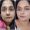 MDW-Before & After-Skin Lightening & Anti Aging Treatment | Facial Fat Removal | Skin Rejuvenation